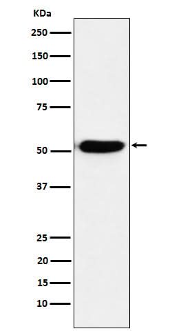 Anti-IRF4 Rabbit Monoclonal Antibody Boster Bio