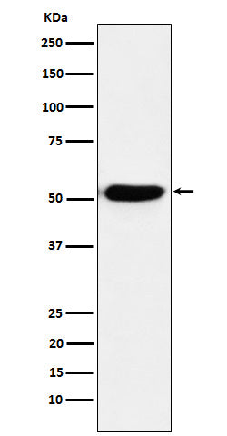 Anti-IRF4 Rabbit Monoclonal Antibody Boster Bio