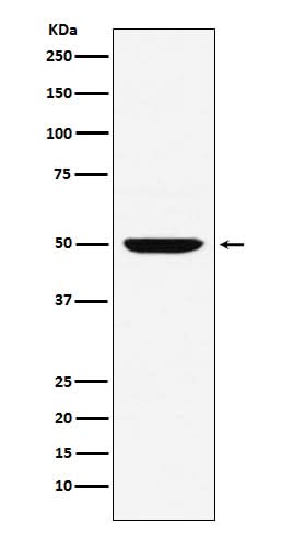 Anti-MUM1 Monoclonal Antibody Boster Bio
