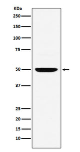 Anti-MUM1 Monoclonal Antibody Boster Bio