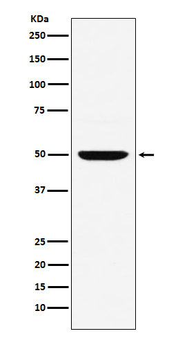 Anti-MUM1 Monoclonal Antibody Boster Bio