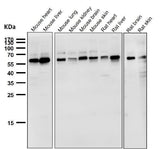 Anti-NOX4 Rabbit Monoclonal Antibody Boster Bio