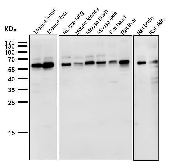 Anti-NOX4 Rabbit Monoclonal Antibody Boster Bio