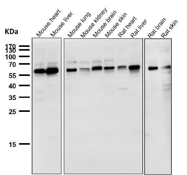 Anti-NOX4 Rabbit Monoclonal Antibody Boster Bio