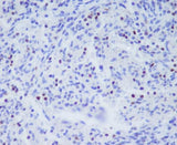 Anti-TBX21 Rabbit Monoclonal Antibody Boster Bio