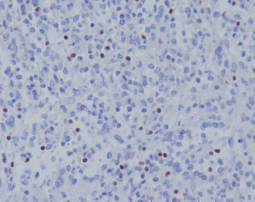 Anti-TBX21 Rabbit Monoclonal Antibody Boster Bio