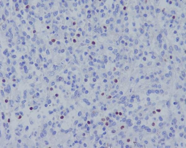 Anti-TBX21 Rabbit Monoclonal Antibody Boster Bio