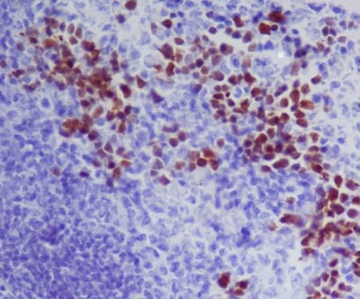 Anti-GATA1 Rabbit Monoclonal Antibody Boster Bio