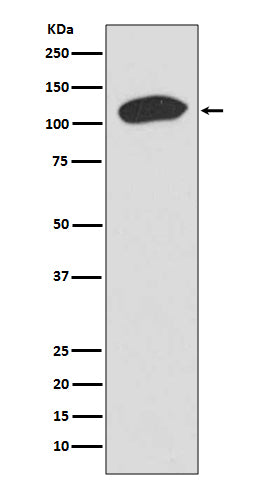 Anti-KAP1 TRIM28 Rabbit Monoclonal Antibody Boster Bio