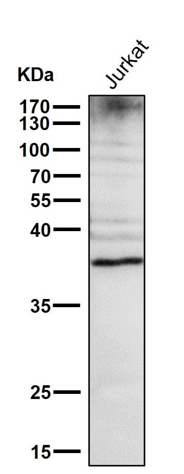 Anti-DR5 Rabbit Monoclonal Antibody Boster Bio