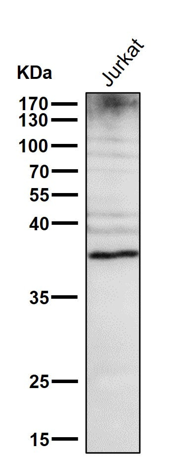 Anti-DR5 Rabbit Monoclonal Antibody Boster Bio