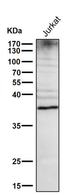 Anti-DR5 Rabbit Monoclonal Antibody Boster Bio