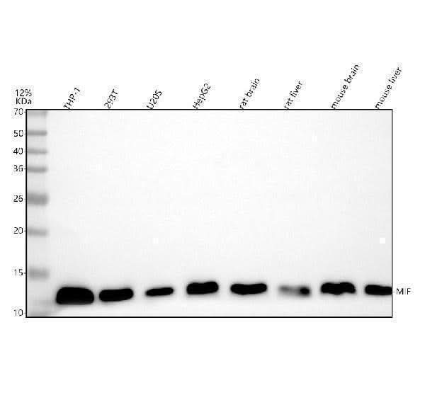 Anti-MIF Rabbit Monoclonal Antibody Boster Bio