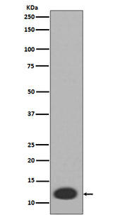 Anti-MRP8 S100A8 Rabbit Monoclonal Antibody Boster Bio