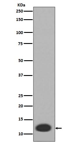 Anti-MRP8 S100A8 Rabbit Monoclonal Antibody Boster Bio