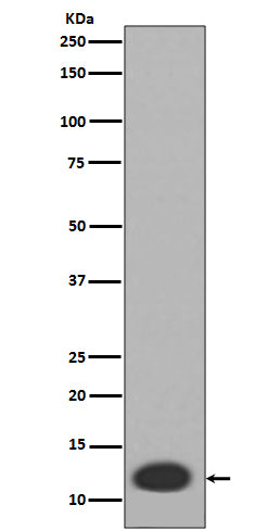 Anti-MRP8 S100A8 Rabbit Monoclonal Antibody Boster Bio