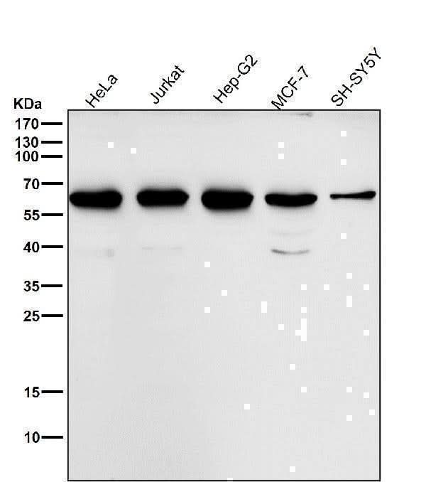 Anti-MMP13 Rabbit Monoclonal Antibody Boster Bio