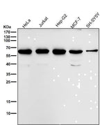 Anti-MMP13 Rabbit Monoclonal Antibody Boster Bio
