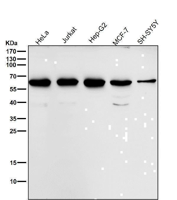 Anti-MMP13 Rabbit Monoclonal Antibody Boster Bio