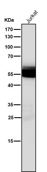 Anti-Lck Monoclonal Antibody Boster Bio
