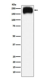 Anti-Niemann Pick C1 Rabbit Monoclonal Antibody Boster Bio