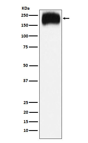 Anti-Niemann Pick C1 Rabbit Monoclonal Antibody Boster Bio