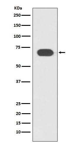 Anti-TCF7L2 Rabbit Monoclonal Antibody Boster Bio