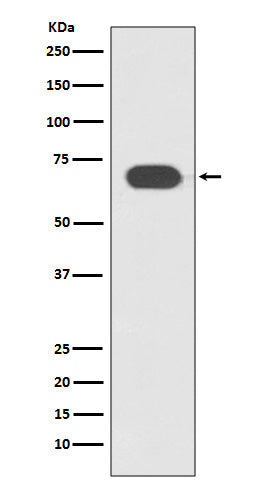 Anti-TCF7L2 Rabbit Monoclonal Antibody Boster Bio