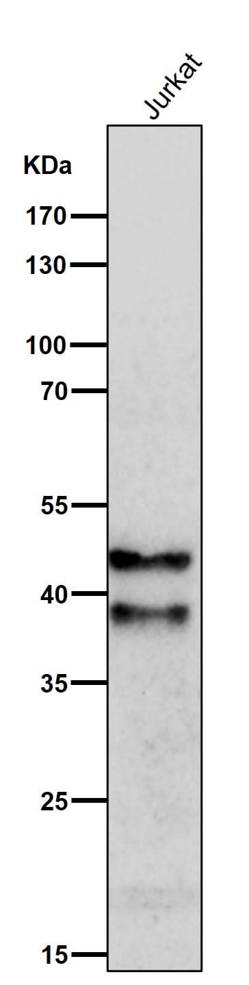 Anti-SIRT2/Sirtuin 2 Rabbit Monoclonal Antibody Boster Bio