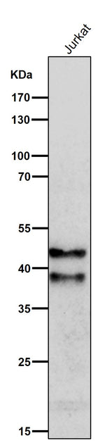 Anti-SIRT2/Sirtuin 2 Rabbit Monoclonal Antibody Boster Bio