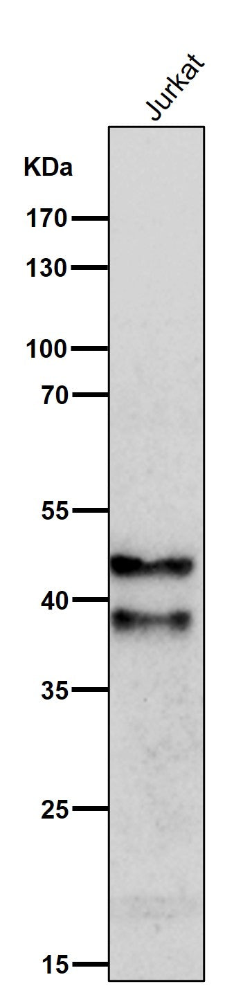 Anti-SIRT2/Sirtuin 2 Rabbit Monoclonal Antibody Boster Bio