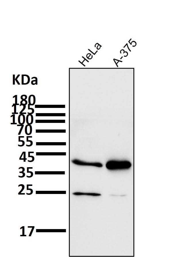 Anti-SIRT2/Sirtuin 2 Rabbit Monoclonal Antibody Boster Bio