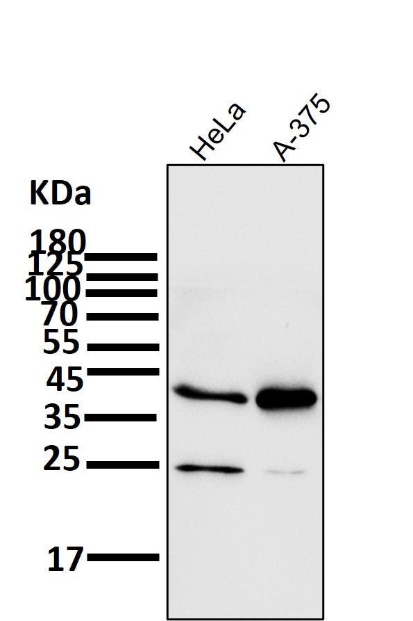 Anti-SIRT2/Sirtuin 2 Rabbit Monoclonal Antibody Boster Bio