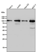 Anti-TOP1/Topoisomerase I Rabbit Monoclonal Antibody Boster Bio