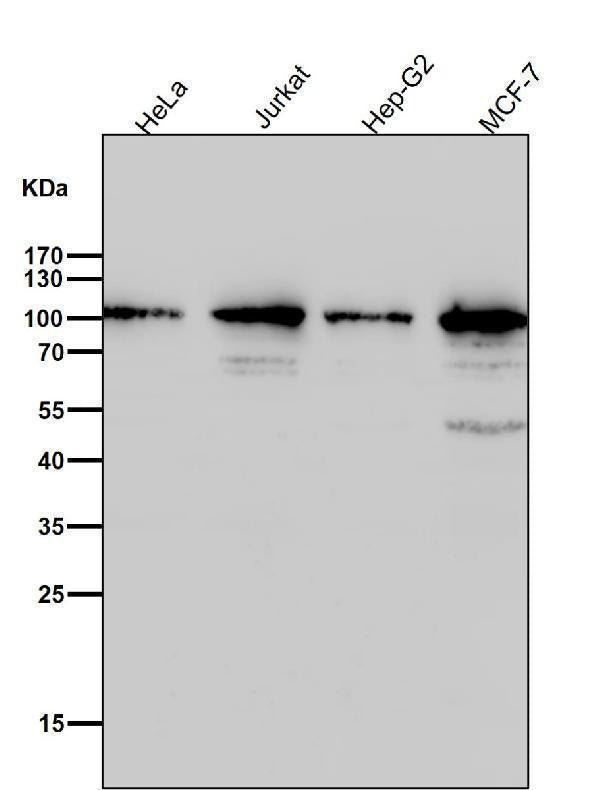 Anti-TOP1/Topoisomerase I Rabbit Monoclonal Antibody Boster Bio