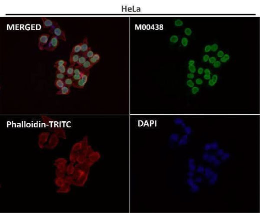 Anti-Lamin A/C LMNA Rabbit Monoclonal Antibody Boster Bio