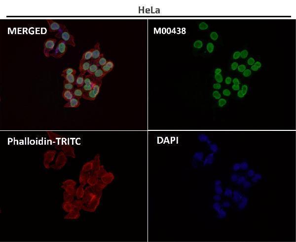 Anti-Lamin A/C LMNA Rabbit Monoclonal Antibody Boster Bio