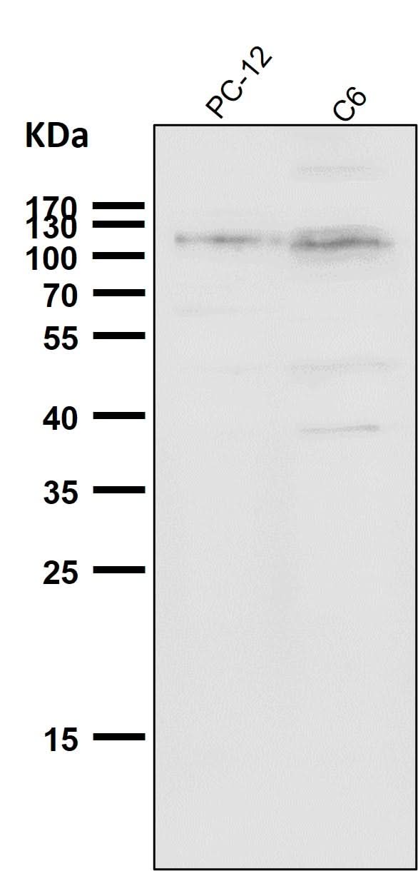 Anti-Daxx Rabbit Monoclonal Antibody Boster Bio