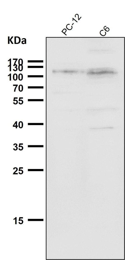 Anti-Daxx Rabbit Monoclonal Antibody Boster Bio