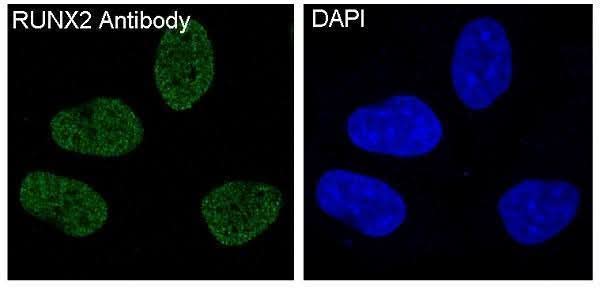 Anti-RUNX2 Monoclonal Antibody Boster Bio