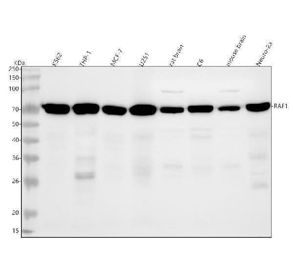 Anti-Raf1 Rabbit Monoclonal Antibody Boster Bio