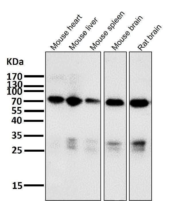 Anti-Raf1 Rabbit Monoclonal Antibody Boster Bio