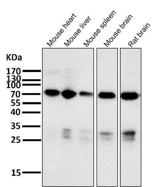Anti-Raf1 Rabbit Monoclonal Antibody Boster Bio