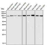 Anti-Insulin Receptor INSR Rabbit Monoclonal Antibody Boster Bio
