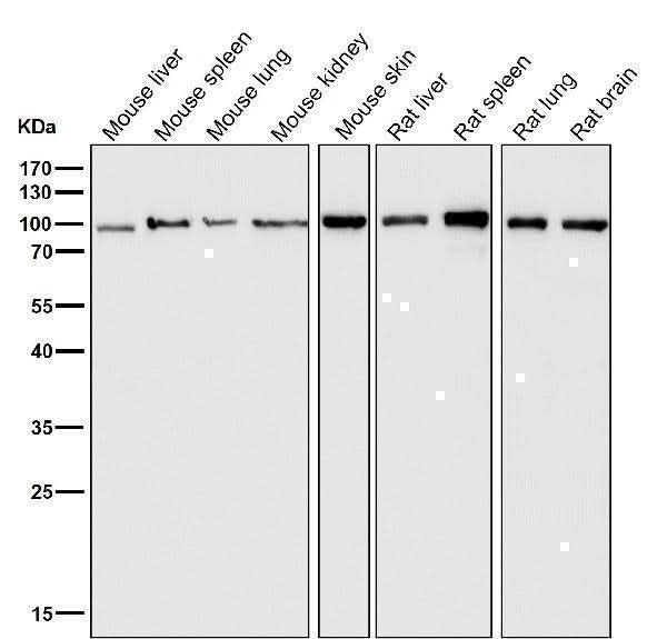 Anti-Insulin Receptor INSR Rabbit Monoclonal Antibody Boster Bio