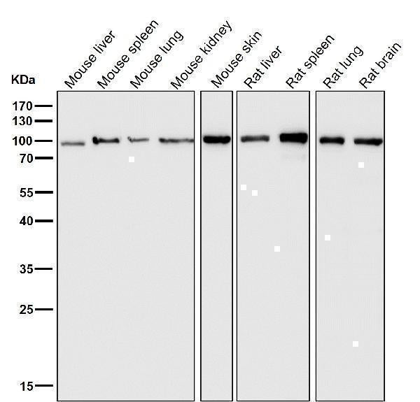 Anti-Insulin Receptor INSR Rabbit Monoclonal Antibody Boster Bio