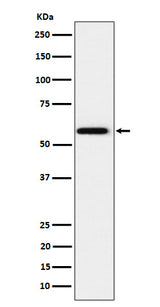 Anti-PPAR gamma Rabbit Monoclonal Antibody Boster Bio