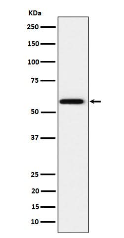 Anti-PPAR gamma Rabbit Monoclonal Antibody Boster Bio
