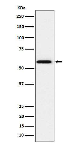 Anti-PPAR gamma Rabbit Monoclonal Antibody Boster Bio