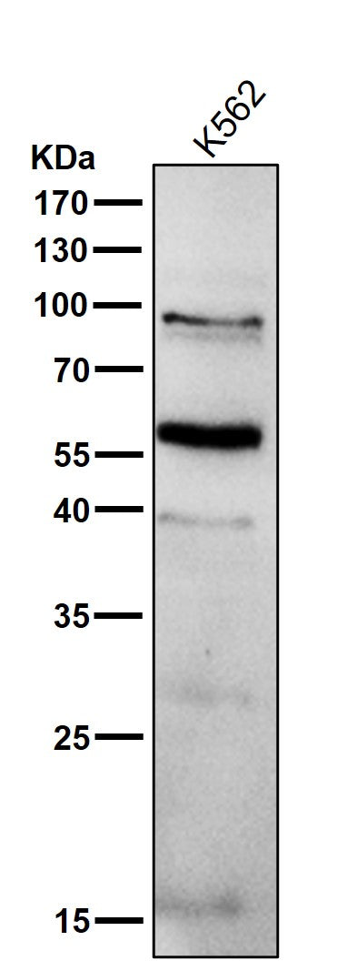 Anti-PPAR gamma Rabbit Monoclonal Antibody Boster Bio